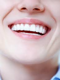 Dicas Caseiras para Clarear Dentes