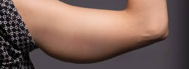 Elimine Gordura do Braço Fácil