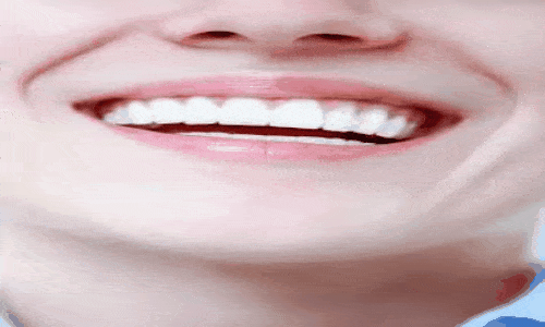 Dicas Caseiras para Clarear Dentes