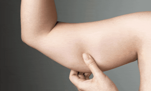Elimine Gordura do Braço Fácil