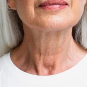 Elimine Pescoço de Peru Dormindo