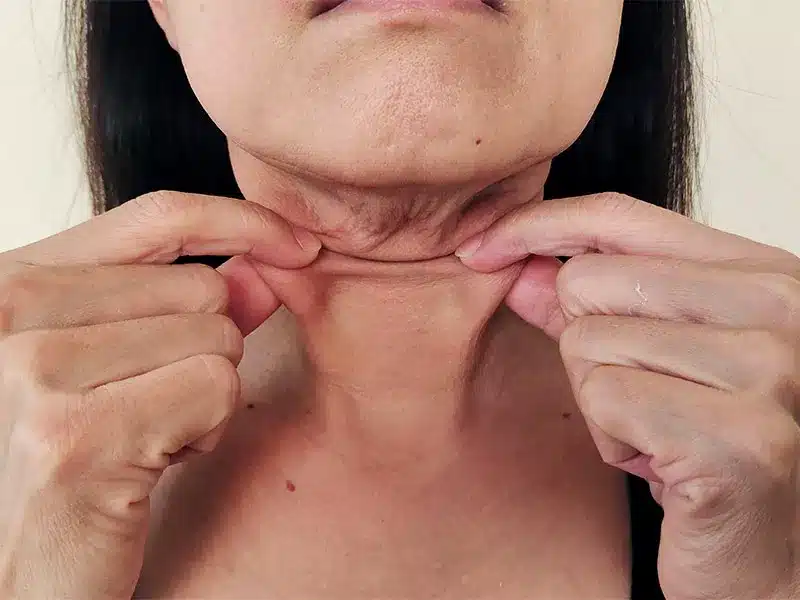 Elimine Pescoço de Peru Dormindo