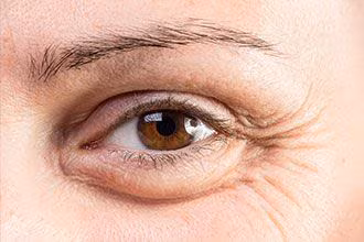 Acorde Renovado: Elimine Bolsas Oculares