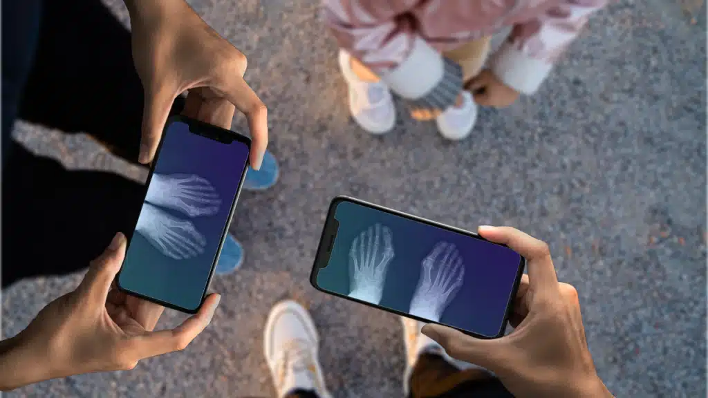 Veja além do comum com Xray Scan