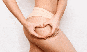 Segredos Naturais Contra Estrias