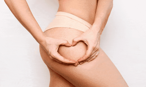 Segredos Naturais Contra Estrias